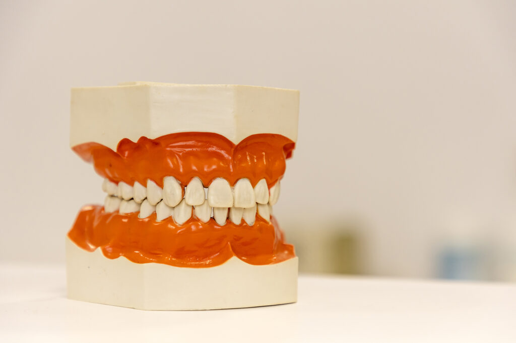 Dentadura bucodental - clínica sops badalona